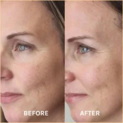 EVOLVE Miracle Vitamin C Mask 60 ml